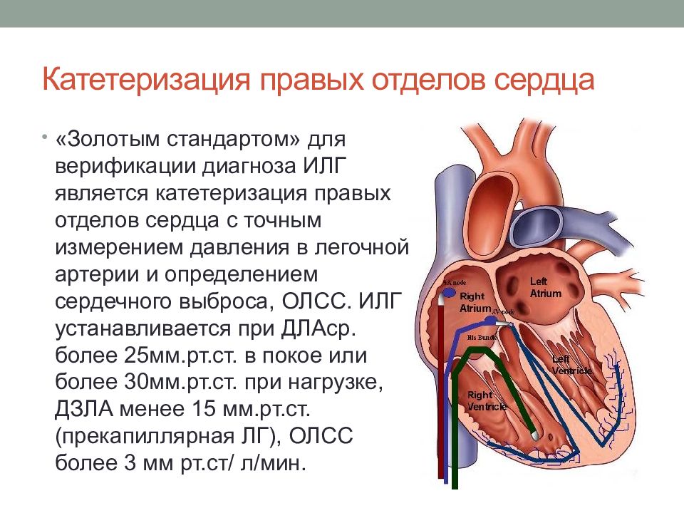 Легочная артериальная гипертензия презентация