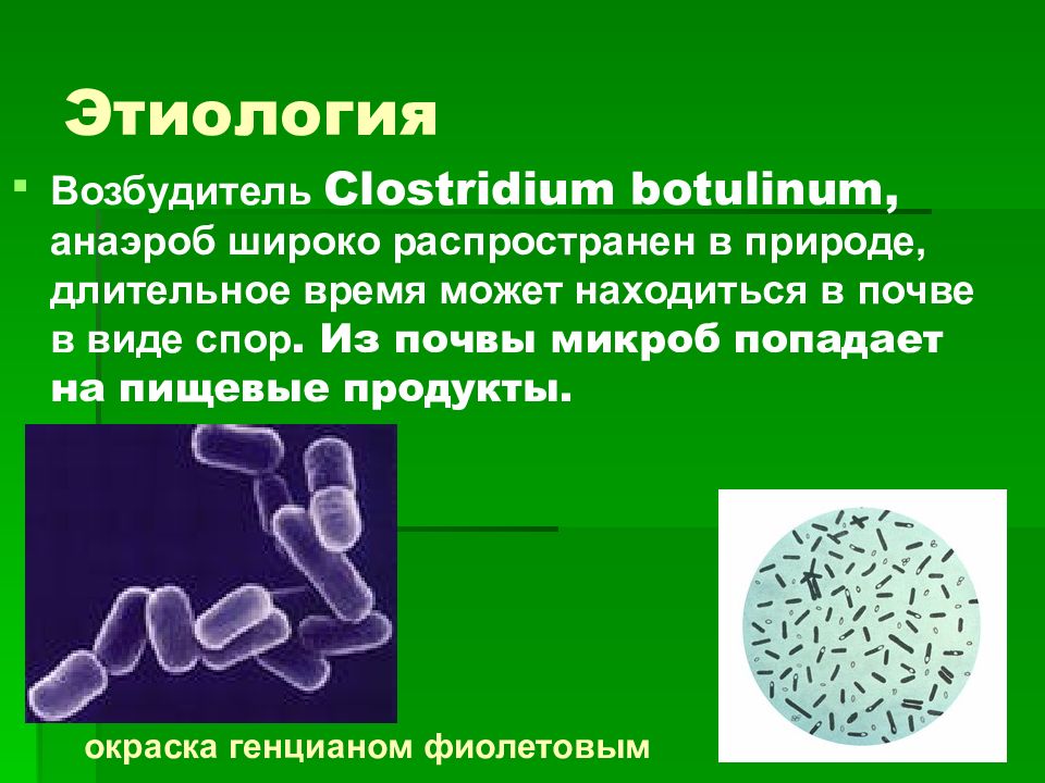 Какая бактерия вызывает ботулизм. Клостридии ботулизма ( Clostridium botulinum ) ботулизм. Бактерии клостридиум. Clostridium botulinum заболевания. Возбудитель - Clostridium botulinum.