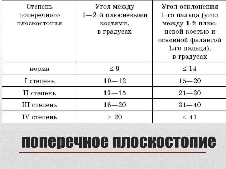 Степени плоскостопия таблица с картинками