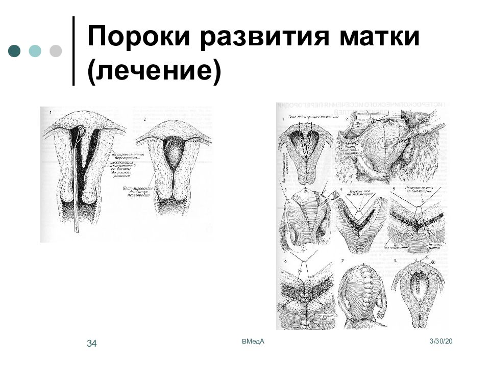 развитие матки. пороки развития репродуктивной системы. пороки женщины. семь смертных грехов чревоугодие. семь смертных грехов обжорство.