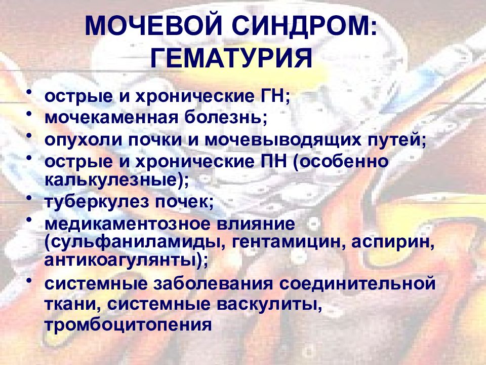 Мочевой синдром норма. Мочевой синдром при простатите. Мочевой. Общий анализ мочи при инфекции мочевыводящих путей. Основные признаки мочевого синдрома.