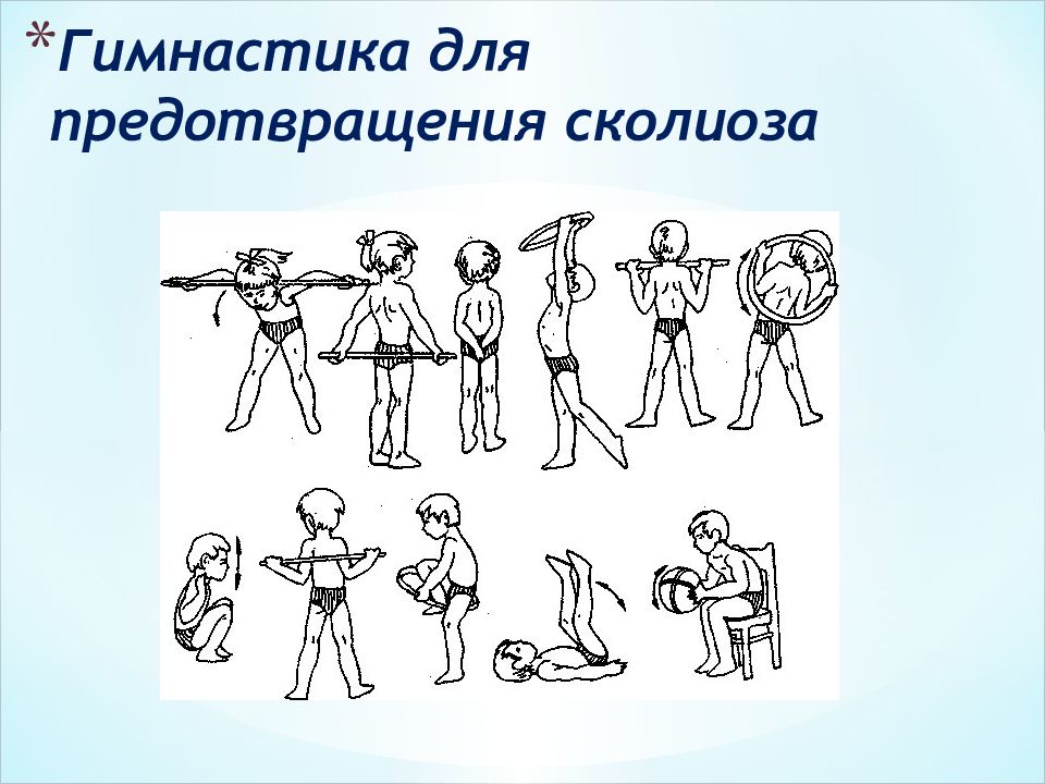 Гимнастика при сколиозе 1 2 степени у подростков картинки