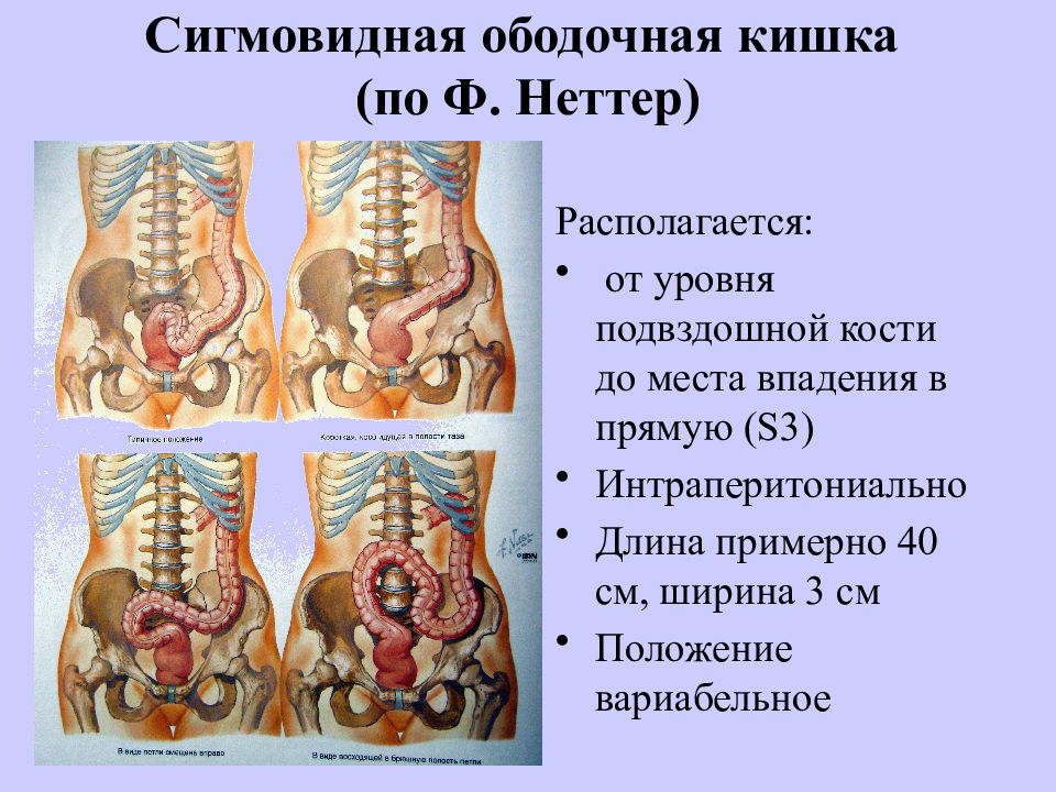 Сигмовидная кишка схема