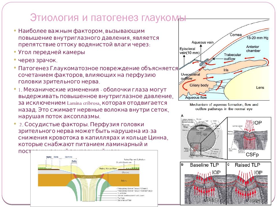 Глаукома презентация офтальмологии