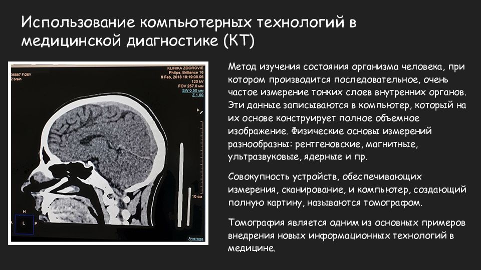 Применение компьютерной графики в медицине презентация