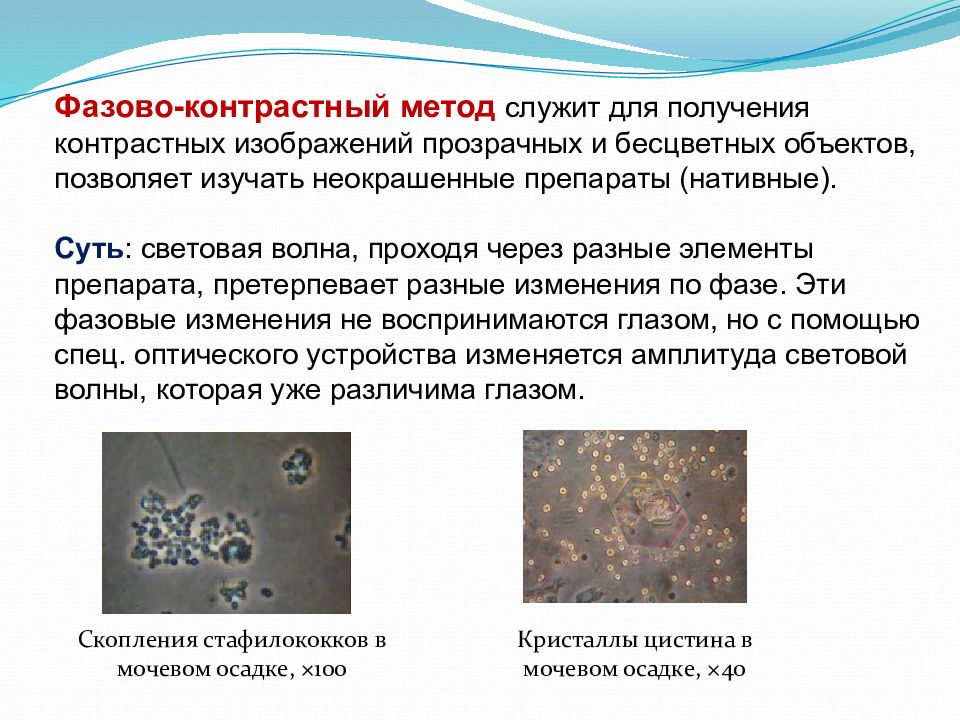 Фазово контрастная микроскопия. Фазово-контрастная микроскопия принцип метода. Метод фазово-контрастной микроскопии. Фазово-контрастная микроскопия суть метода. Фазово контрастный микроскоп бактерии.
