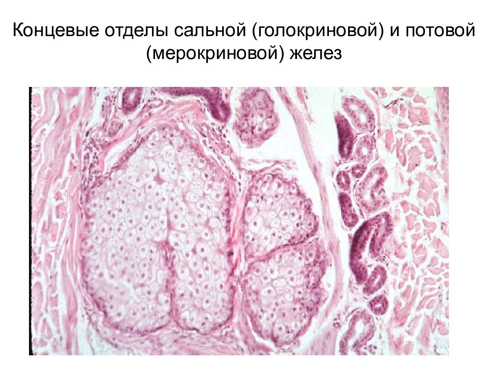 железистый эпителий гистология. концевые отделы потовых желез. сальная железа кожи человека гистология. типы секреции гистология голокриновый. железистый эпителий сальная железа.