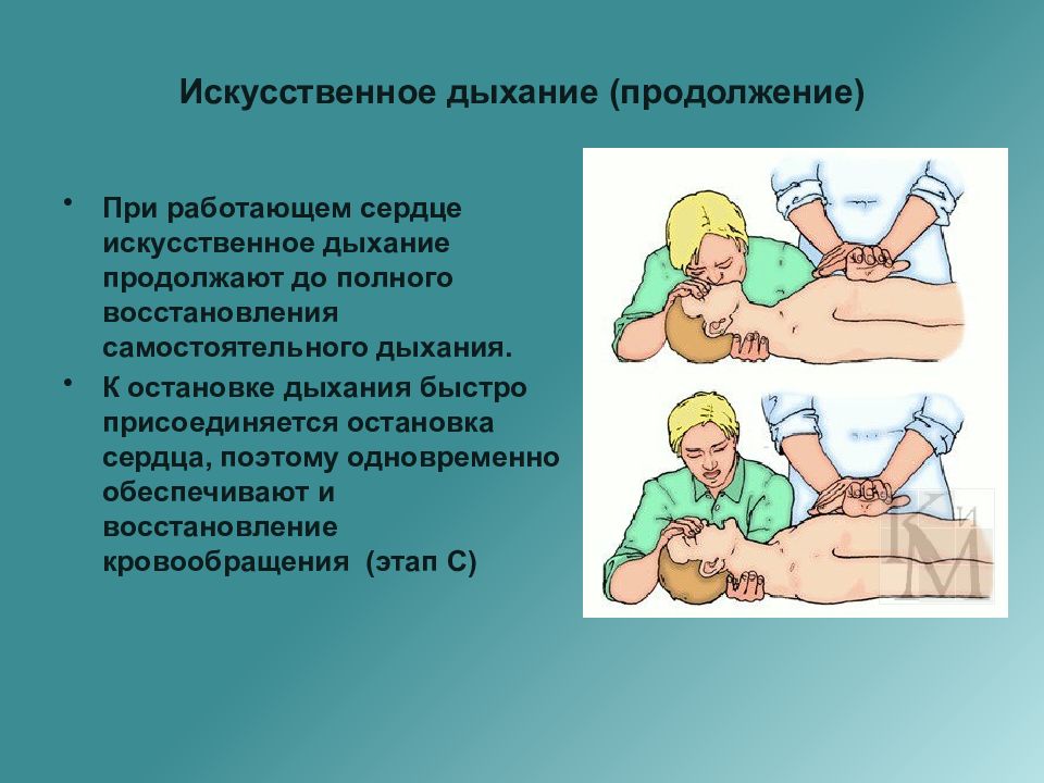 Искусственное дыхание презентация