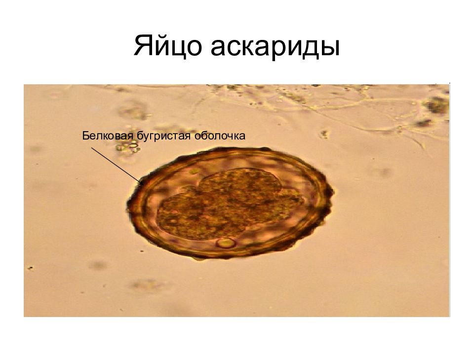 Яйцо аскариды рисунок