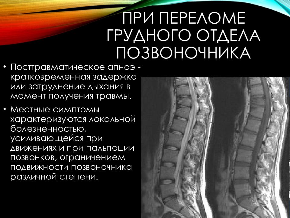 Переломы позвоночника презентация