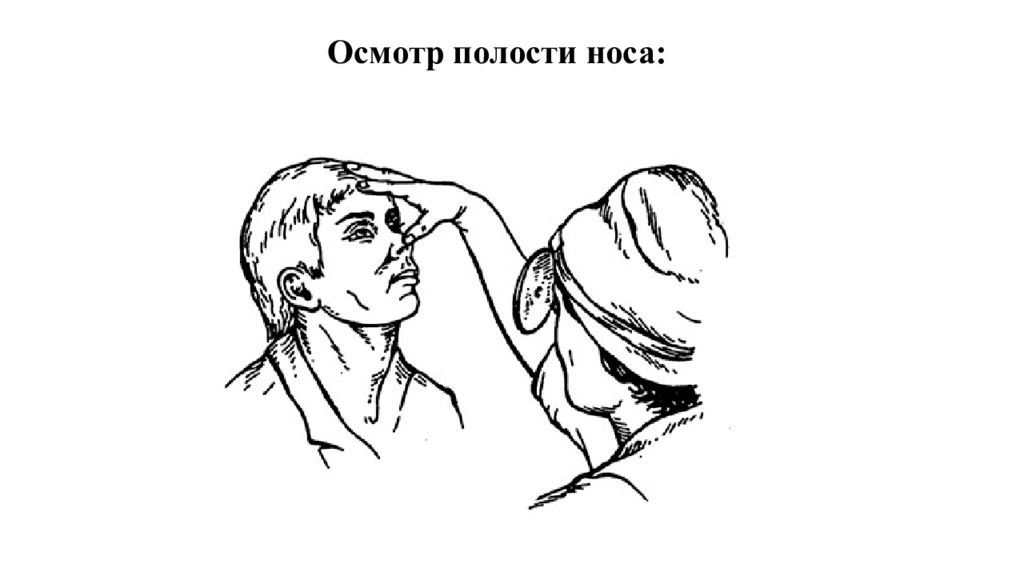 Осмотр носа. Осмотр носовой полости. Методики осмотра полости носа. Методом осмотра полости носа является.