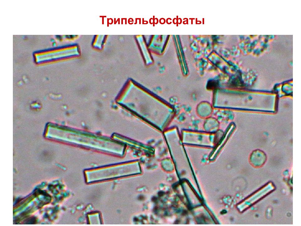 Осадки мочи под микроскопом в картинках