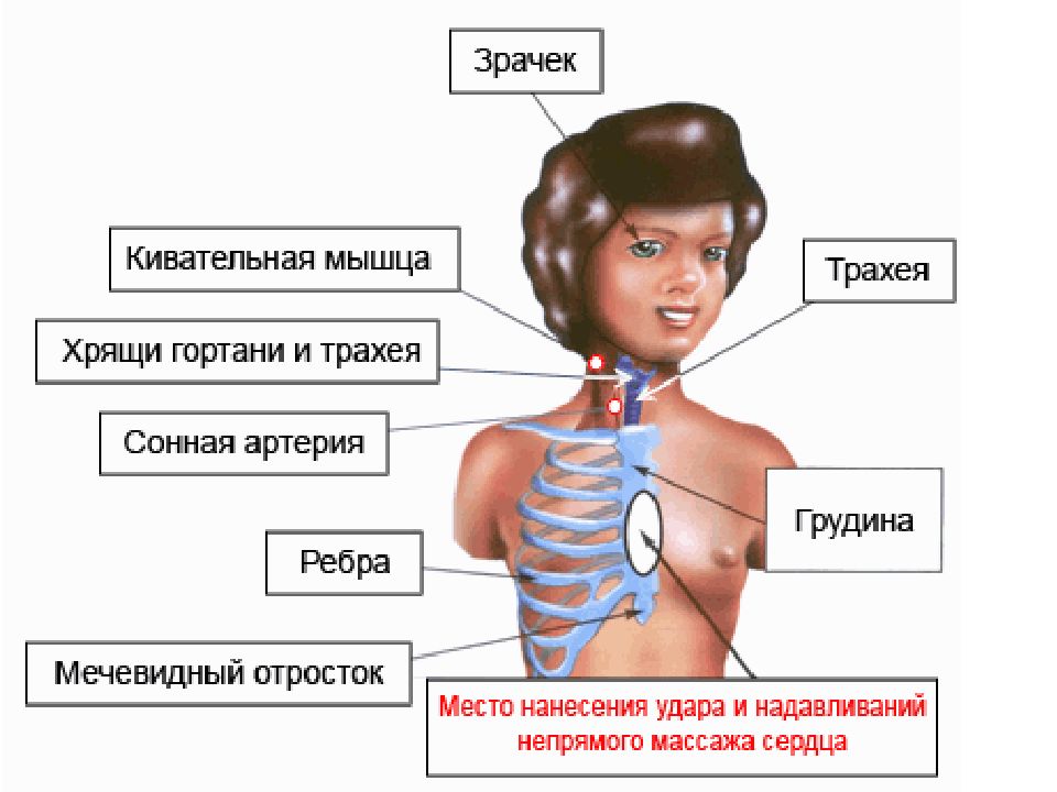 Мечевидный отросток грудины. Кивательная мышца. Анатомические ориентиры для проведения сердечно-легочной реанимации. Расположение кивательной мышцы.