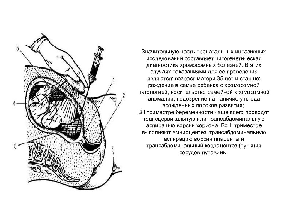 Головка плода как объект родов презентация