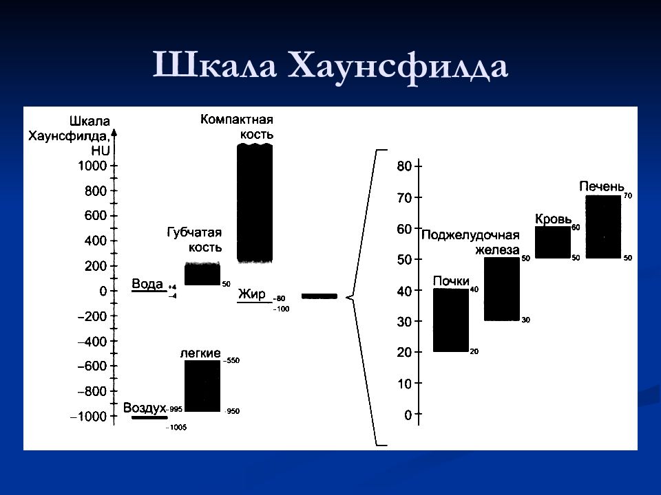 Шкала хаунсфилда презентация