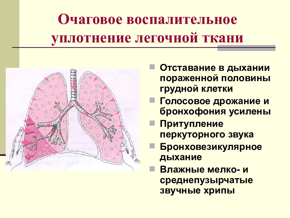 Презентация пропедевтика внутренних болезней дыхательная система