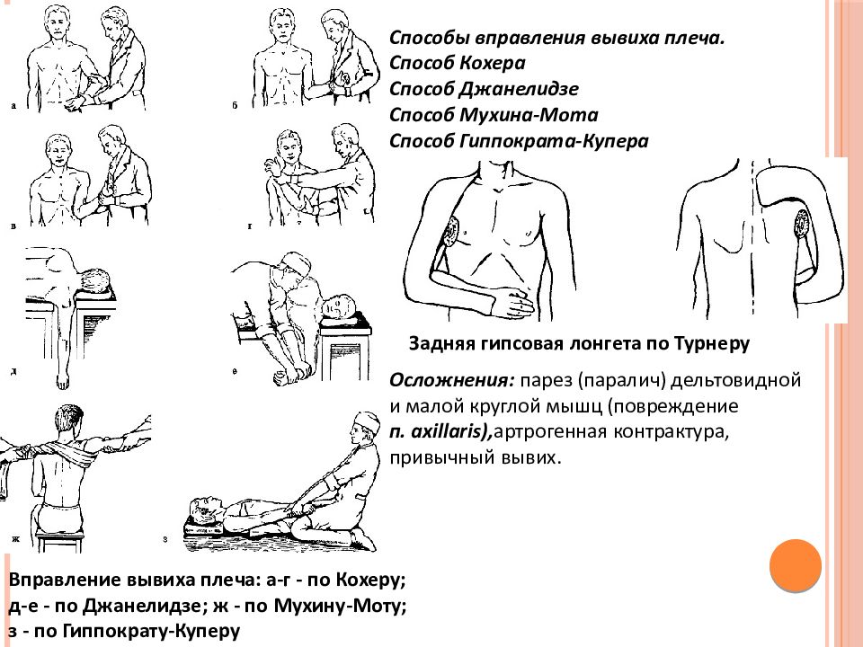 Повреждения плечевого пояса презентация