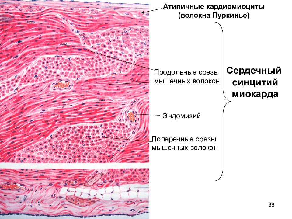 Миокард на рисунке