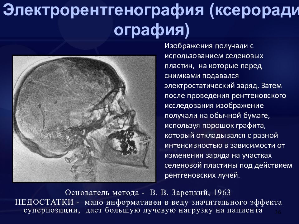 При электрорентгенографии изображение получают