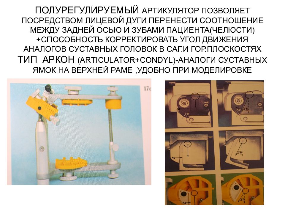 Позволит посредством. Артикулятор non arcon. Arcon non arcon артикулятор. Полурегулируемый артикулятор. Полурегулируемые артикуляторы arcon.