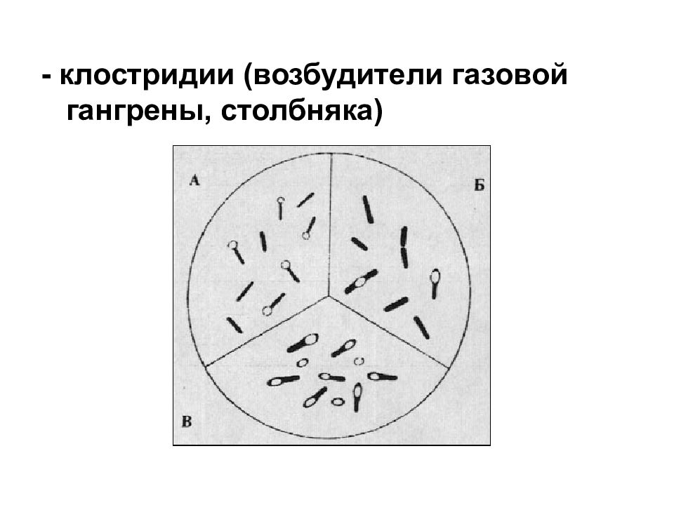 Возбудитель газовой гангрены рисунок