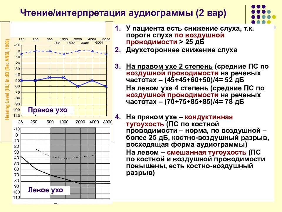 Графическое изображение на специальном бланке данных исследования состояния слуха проводимого с