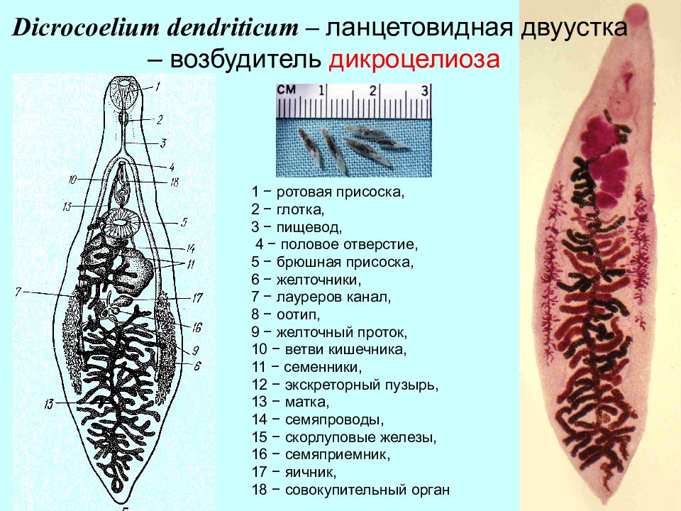 Ланцетовидный сосальщик. Ланцетовидный сосальщик - дикроцелиоз-. Dicrocoelium lanceatum строение.