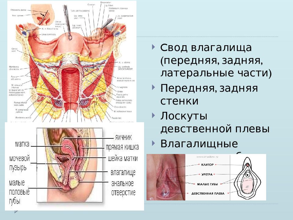 Своды Влагалища Фото