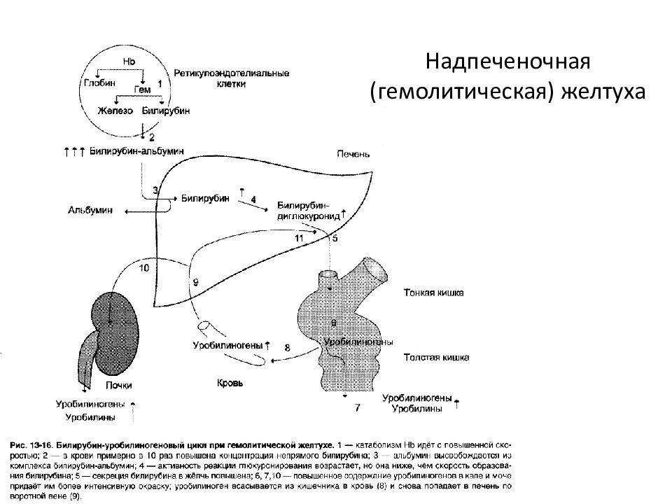 Схема обезвреживания билирубина