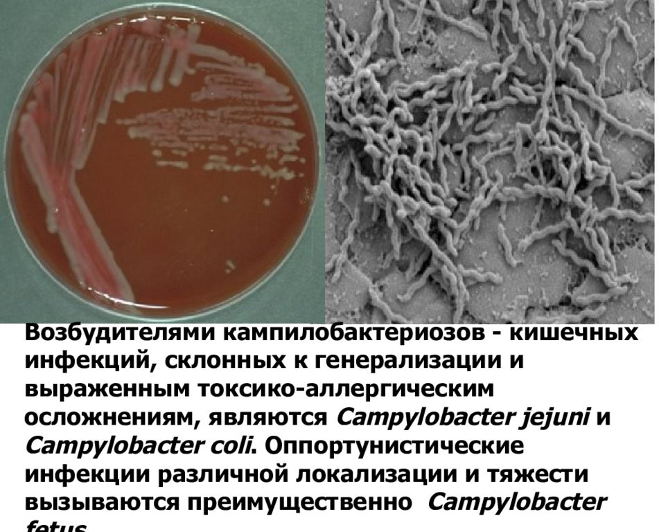Кампилобактериоз возбудитель. Острые кишечные инфекции презентация. Возбудители острых кишечных инфекций. Осложнение острых кишечных инфекций. Кал на возбудителей кишечных инфекций