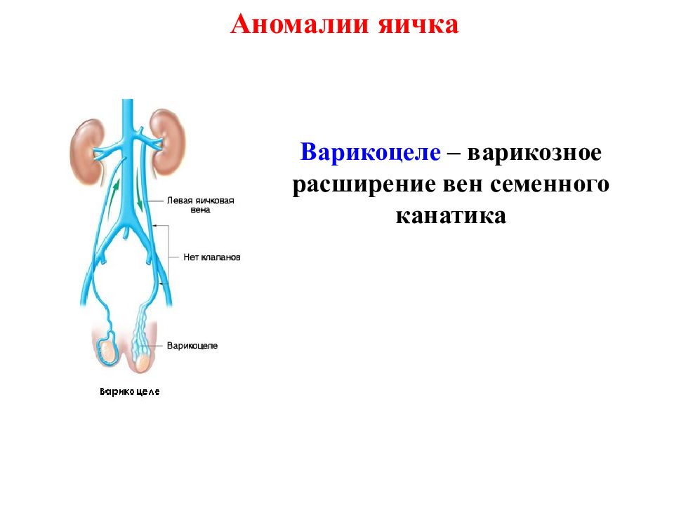 Презентация аномалии яичек