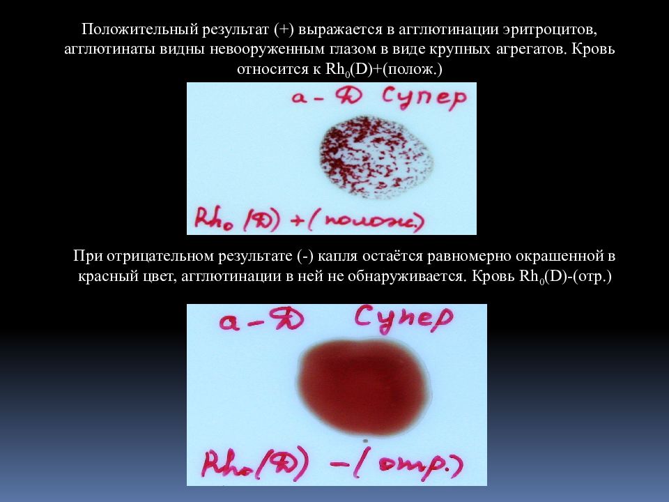 Группа крови агглютинация картинки