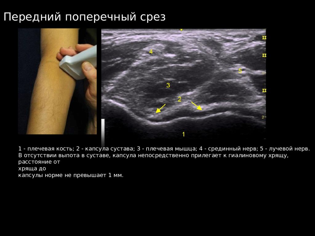 Презентация узи коленного сустава