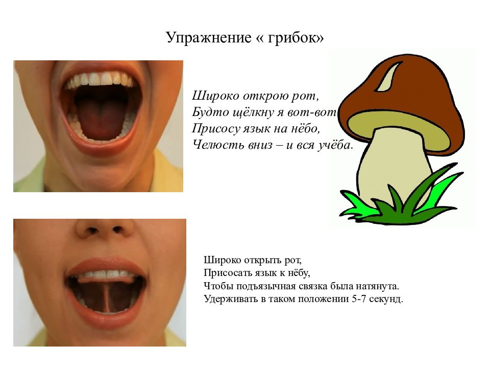 Артикуляционная апраксия презентация