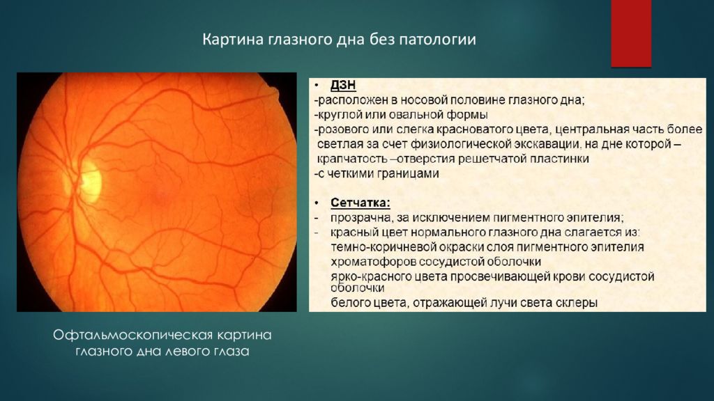 Норма зрительного нерва. Офтальмоскопия глазного дна описание. Офтальмоскопия глазного дна норма. Осмотр глазного дна описание нормы. Изменения на глазном дне.