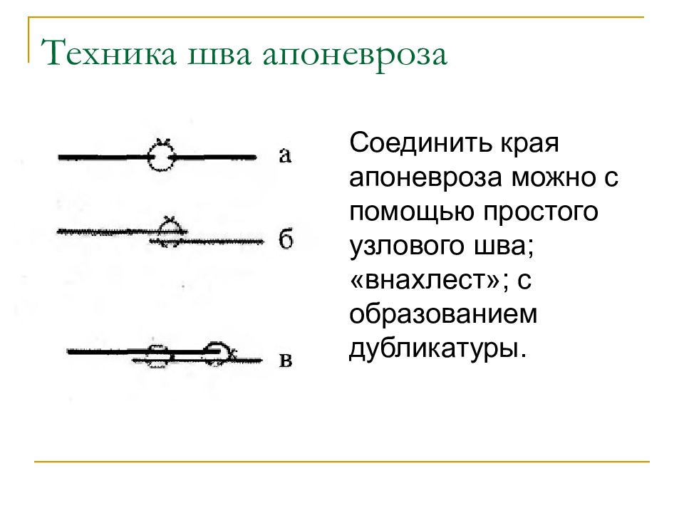 Край соединить. Простой Узловой шов апоневроза. Шов апоневроза внахлест.