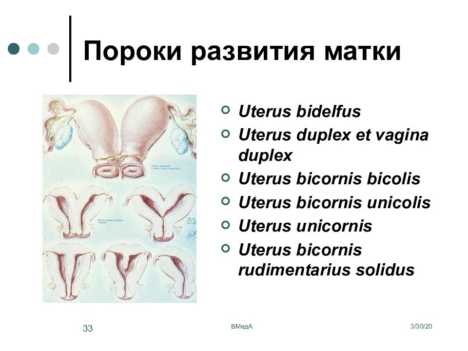 Аномалии развития женской репродуктивной системы презентация