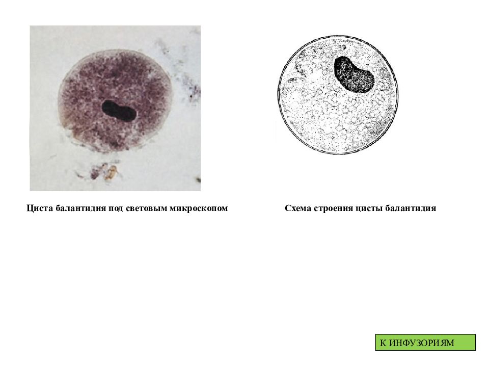 Циста. Циста балантидия. Циста балантидия под микроскопом. Циста балантидия строение. Балантидий амеба микроскоп.