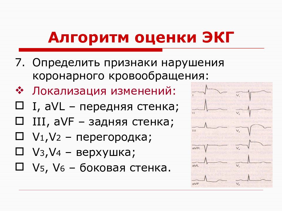 Оценка экг по фото онлайн