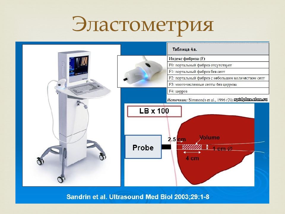 фиброскан печени в екатеринбурге