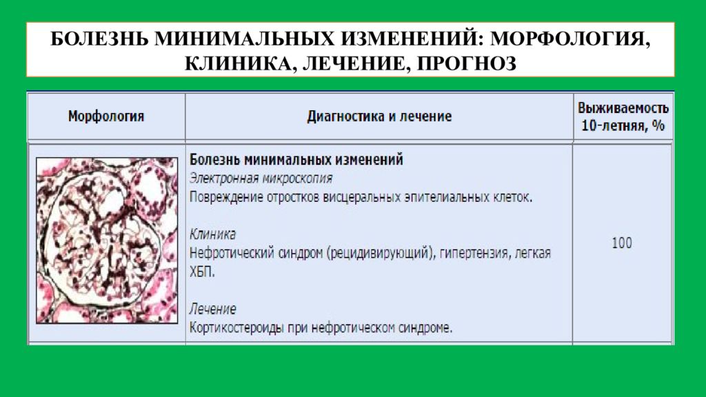 Минимальных изменений. Болезнь минимальных изменений. Болезнь минимальных изменений морфология. Болезнь минимальных изменений клиника. Болезнь минимальных изменений гломерулонефрит.