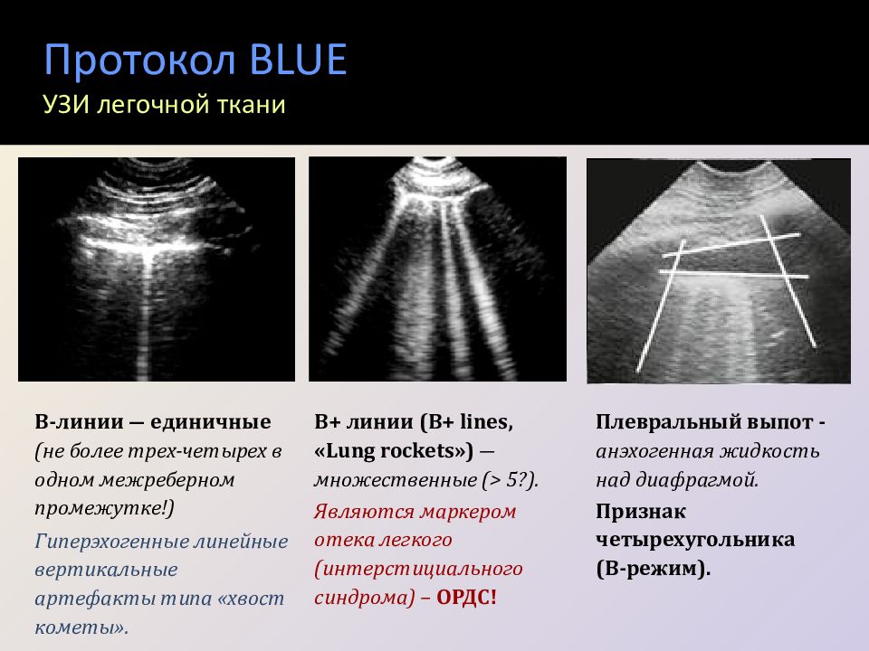 Узи плевральной. УЗИ плевральных полостей протокол. УЗИ плевральной полости протокол УЗИ. Протокол исследования плевральных полостей ультразвукового. Blu протокол УЗИ.