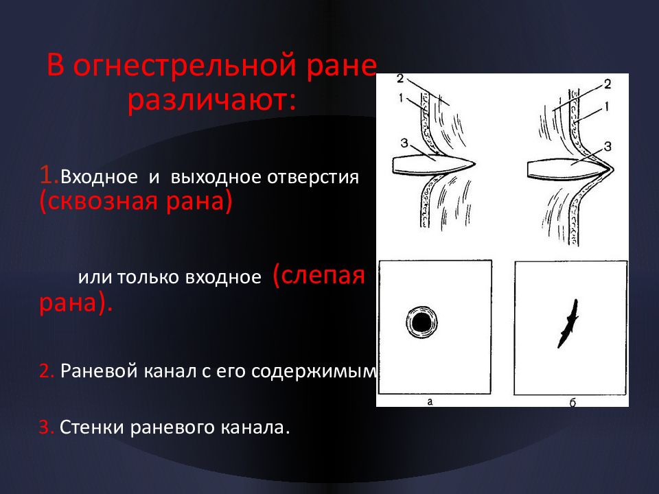 Осколок направление. Входное отверстие огнестрельной раны характеризуется:. Входное отверстие раневого канала при огнестреле. Входная и выходная рана огнестрельная. Сквозное огнестрельное ранение.