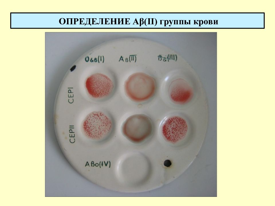 Современные методы определения группы крови презентация