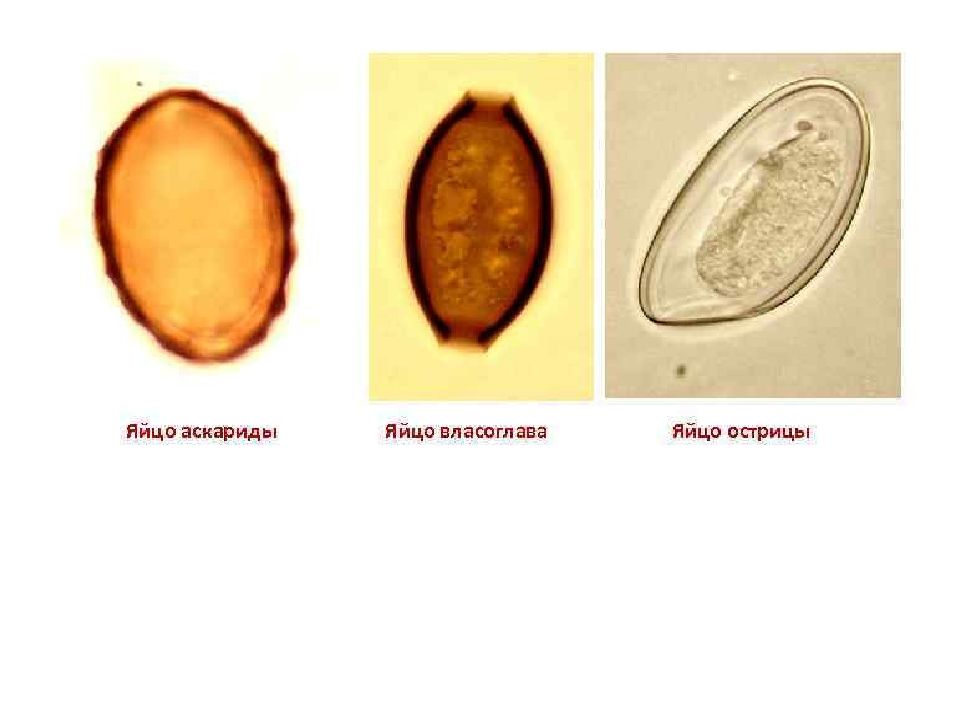 Яйца аскарид. Яйцо аскариды препарат биология. Аскариды, острицы, власоглавы. Яйца. Яйца власоглава. Яйцо власоглава строение.