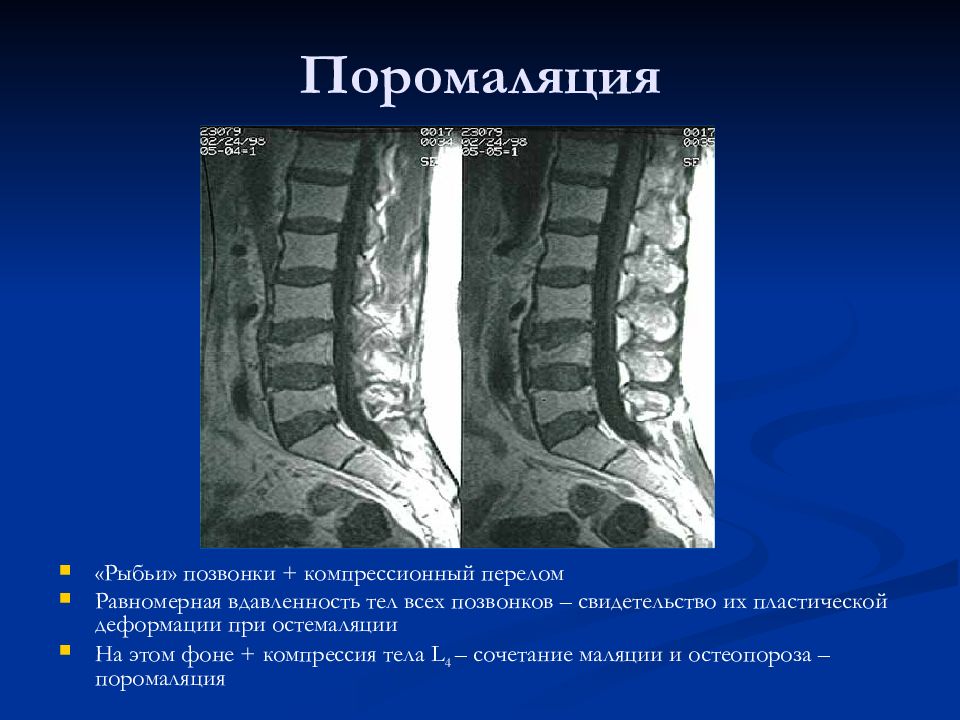 Лучевая диагностика позвоночник презентация