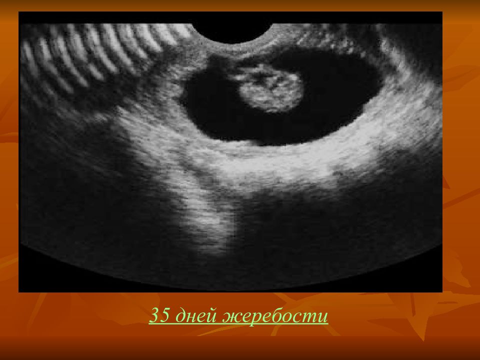 ультразвуковая диагностика беременности. узи диагностика стельности у коров. лабораторные методы диагностика беременности. узи крс что это такое в ветеринарий. диагностика беременности у животных.