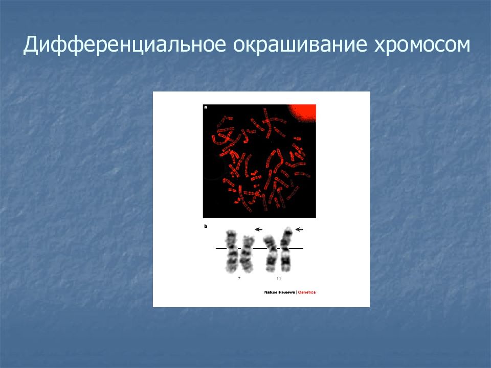 Окраска хромосом. Дифференциальное окрашивание хромосом. Дифференциальное окрашивание. Дифференциальная окраска хромосом. Методы дифференциальной окраски хромосом.