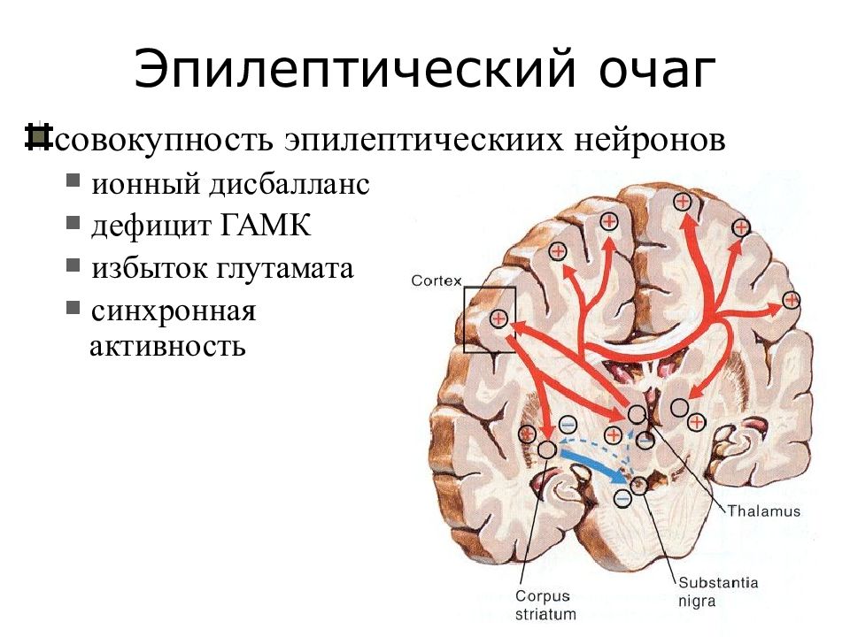 Эпилепсия неврология презентация