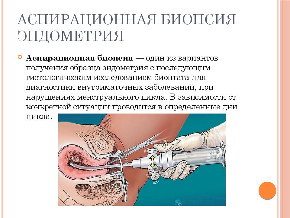 Аспирационная биопсия картинки